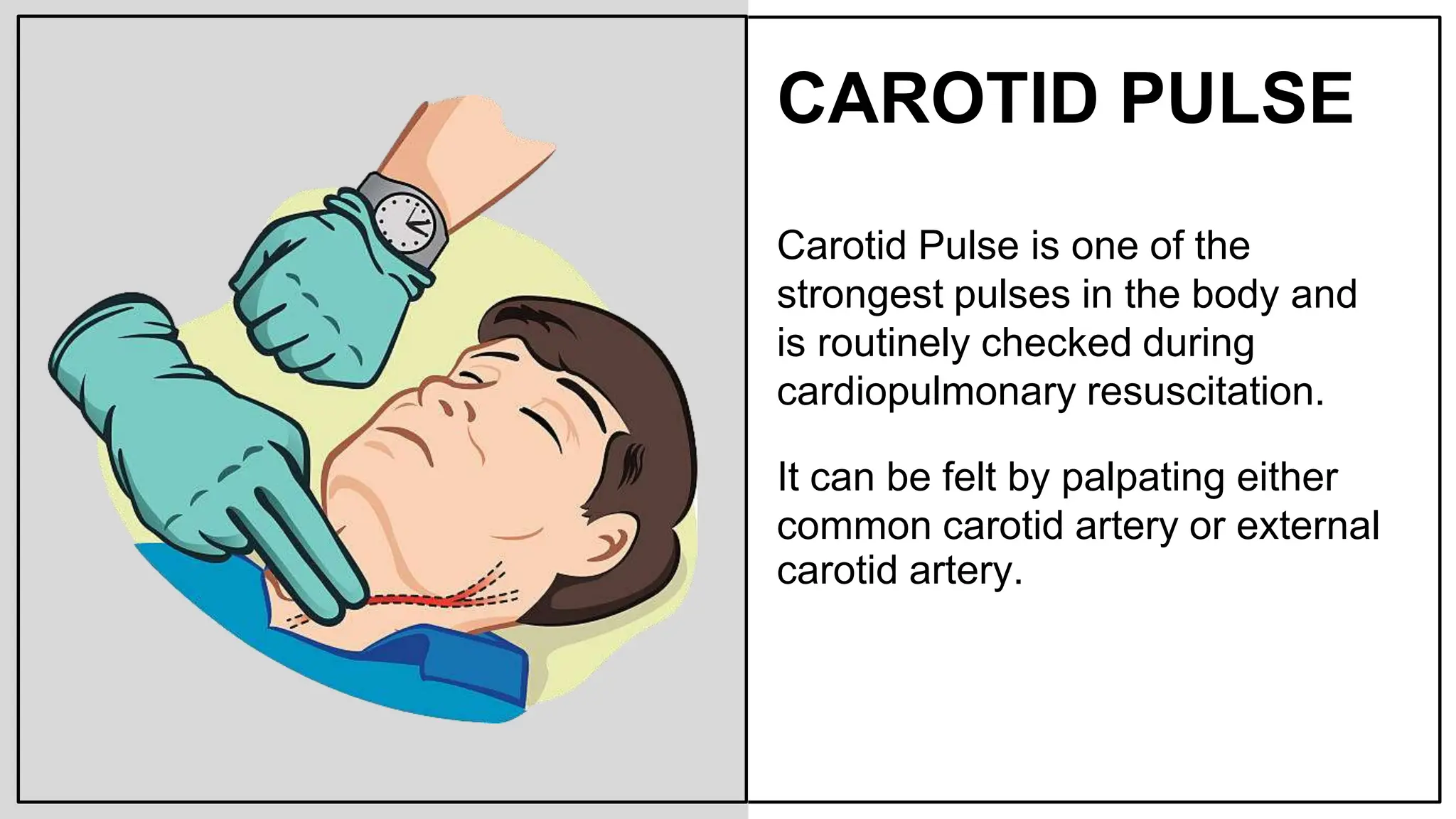 Carotid Triangle pptx