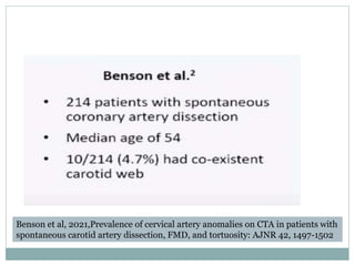 Benson et al, 2021,Prevalence of cervical artery anomalies on CTA in patients with
spontaneous carotid artery dissection, FMD, and tortuosity: AJNR 42, 1497-1502
 