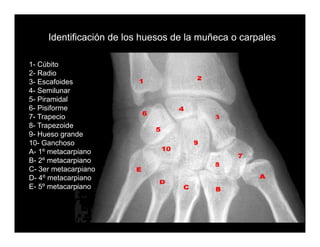Carpal