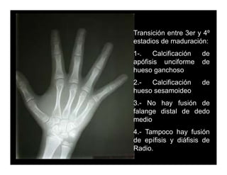 Carpal