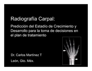 Radiografía Carpal:
Predicción del Estadío de Crecimiento y
Desarrollo para la toma de decisiones en
el plan de tratamiento




Dr. Carlos Martínez T
León, Gto. Méx.