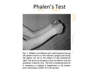 Phalen’s Test
 
