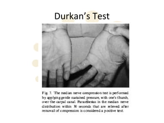 Durkan’s Test
 