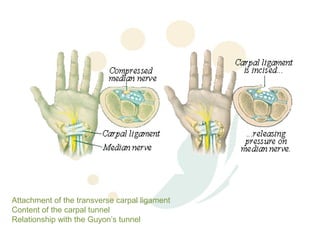 Attachment of the transverse carpal ligament
Content of the carpal tunnel
Relationship with the Guyon’s tunnel
 