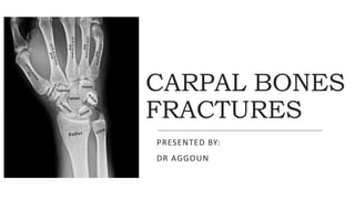 CARPAL BONES
FRACTURES
PRESENTED BY:
DR AGGOUN
 