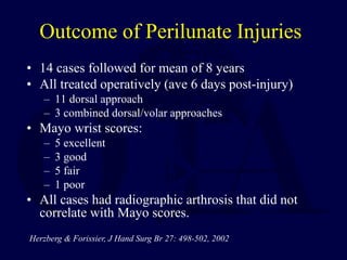 Outcome of Perilunate Injuries
• 14 cases followed for mean of 8 years
• All treated operatively (ave 6 days post-injury)
– 11 dorsal approach
– 3 combined dorsal/volar approaches
• Mayo wrist scores:
– 5 excellent
– 3 good
– 5 fair
– 1 poor
• All cases had radiographic arthrosis that did not
correlate with Mayo scores.
Herzberg & Forissier, J Hand Surg Br 27: 498-502, 2002
 