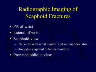 Radiographic Imaging of
Scaphoid Fractures
• PA of wrist
• Lateral of wrist
• Scaphoid view
– PA x-ray with wrist neutral and in ulnar deviation
– elongates scaphoid to better visualize
• Pronated oblique view
 