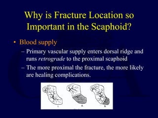 Why is Fracture Location so
Important in the Scaphoid?
• Blood supply
– Primary vascular supply enters dorsal ridge and
runs retrograde to the proximal scaphoid
– The more proximal the fracture, the more likely
are healing complications.
 