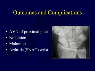 Outcomes and Complications
• AVN of proximal pole
• Nonunion
• Malunion
• Arthritis (SNAC) wrist
 