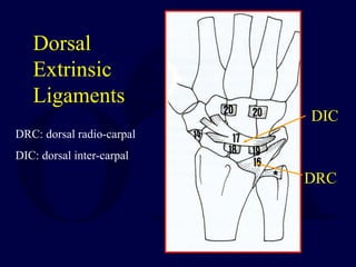 Dorsal
Extrinsic
Ligaments
DIC
DRC
DRC: dorsal radio-carpal
DIC: dorsal inter-carpal
 