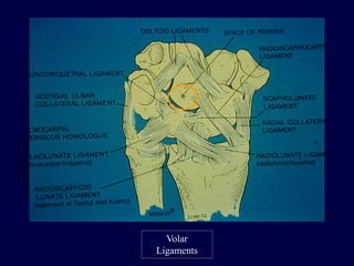 Volar
Ligaments
 