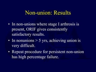 Non-union: Results
• In non-unions where stage I arthrosis is
present, ORIF gives consistently
satisfactory results.
• In nonunions > 5 yrs, achieving union is
very difficult.
• Repeat procedure for persistent non-union
has high percentage failure.
 