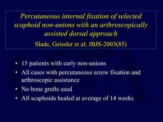 Percutaneous internal fixation of selected
scaphoid non-unions with an arthroscopically
assisted dorsal approach
Slade, Geissler et al; JBJS-2003(85)
• 15 patients with early non-unions
• All cases with percutaneous screw fixation and
arthroscopic assistance
• No bone grafts used
• All scaphoids healed at average of 14 weeks
 