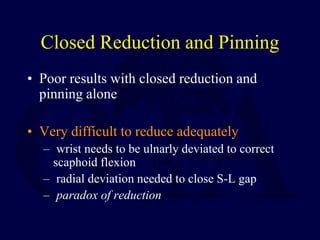 Closed Reduction and Pinning
• Poor results with closed reduction and
pinning alone
• Very difficult to reduce adequately
– wrist needs to be ulnarly deviated to correct
scaphoid flexion
– radial deviation needed to close S-L gap
– paradox of reduction
 
