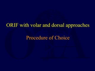 ORIF with volar and dorsal approaches
Procedure of Choice
 