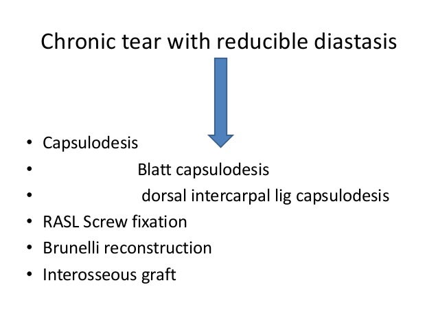 Calculate Pi Injury Lasialt Calculate Pi Injury Lasialt