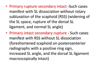 anatomy of wrist and carpal bones | PPTX