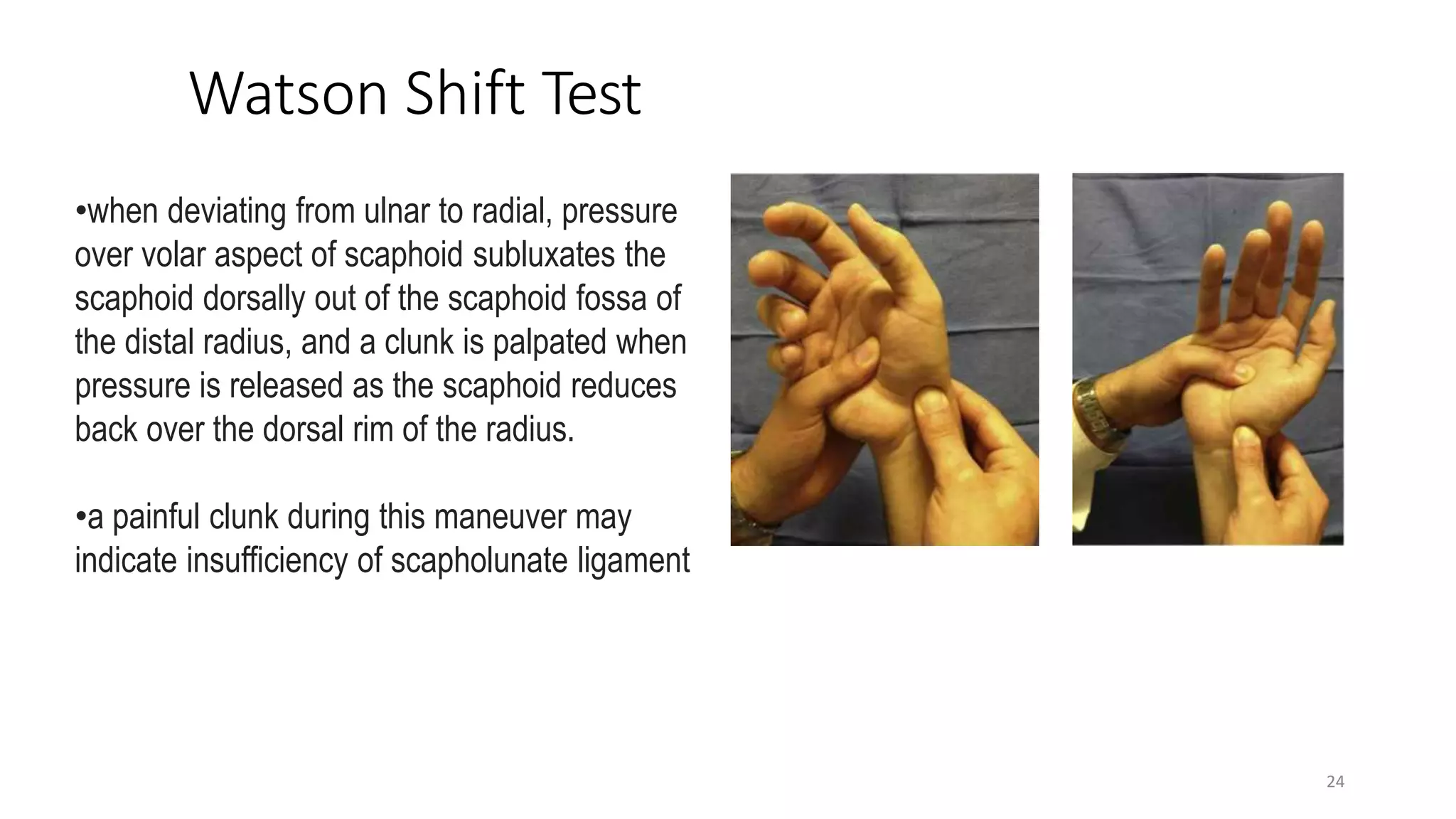 carpal instability & management.pptx