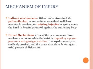 Comprehensive Overview of Carpal Instability: Anatomy, Kinematics, and ...