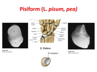 Pisiform (L. pisum, pea)
 