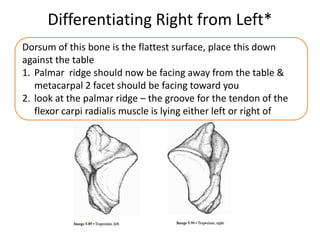 Differentiating Right from Left*
Dorsum of this bone is the flattest surface, place this down
against the table
1. Palmar ridge should now be facing away from the table &
metacarpal 2 facet should be facing toward you
2. look at the palmar ridge – the groove for the tendon of the
flexor carpi radialis muscle is lying either left or right of
 