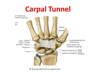 Carpal Tunnel
 