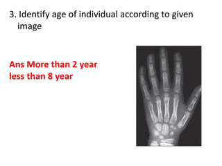 3. Identify age of individual according to given
image
Ans More than 2 year
less than 8 year
 