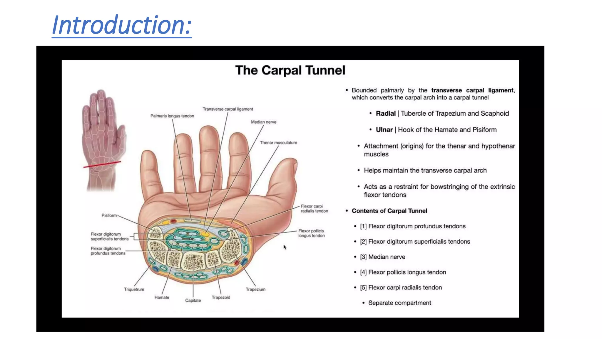 Carpal Tunnel Release