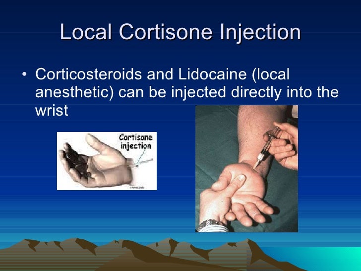 Carpal tunnel syndrome