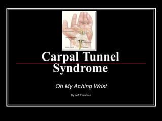 Carpal Tunnel Syndrome Oh My Aching Wrist By Jeff Freshour 