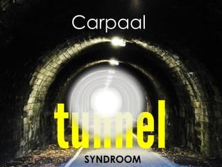 Carpaal

SYNDROOM

 
