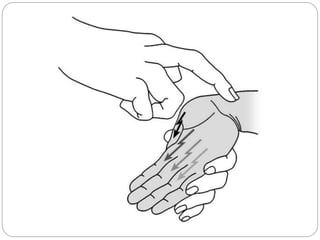 Risk factors
 Repetitive manual tasks with flexion and
extension of the hand at the wrist
 Forceful gripping with the ha...