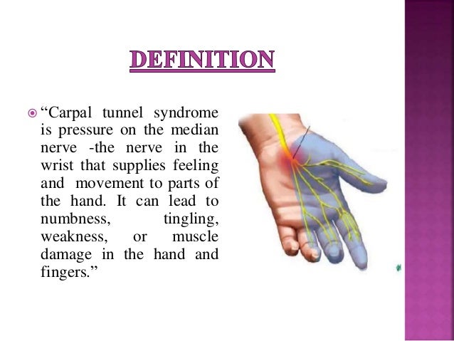 carpal tunnel syndrome thesis carpal tunnel syndrome thesis