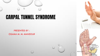 CARPAL TUNNEL SYNDROME
PRESENTED BY :
OSAMA M. M. MANSOUR
 