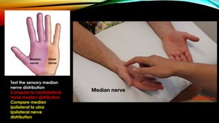 Contralateral Hand Use Carpal Tunnel Syndrome presentation.pptx
