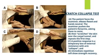 Carpal tunnel syndrome of hand in diabetes | PPTX