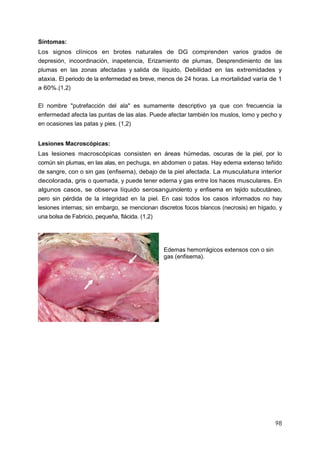 98
Síntomas:
Los signos clínicos en brotes naturales de DG comprenden varios grados de
depresión, incoordinación, inapetencia, Erizamiento de plumas, Desprendimiento de las
plumas en las zonas afectadas y salida de líquido, Debilidad en las extremidades y
ataxia. El periodo de la enfermedad es breve, menos de 24 horas. La mortalidad varía de 1
a 60%.(1,2)
El nombre "putrefacción del ala" es sumamente descriptivo ya que con frecuencia la
enfermedad afecta las puntas de las alas. Puede afectar también los muslos, lomo y pecho y
en ocasiones las patas y pies. (1,2)
Lesiones Macroscópicas:
Las lesiones macroscópicas consisten en áreas húmedas, oscuras de la piel, por lo
común sin plumas, en las alas, en pechuga, en abdomen o patas. Hay edema extenso teñido
de sangre, con o sin gas (enfisema), debajo de la piel afectada. La musculatura interior
decolorada, gris o quemada, y puede tener edema y gas entre los haces musculares. En
algunos casos, se observa líquido serosanguinolento y enfisema en tejido subcutáneo,
pero sin pérdida de la integridad en Ia piel. En casi todos los casos informados no hay
lesiones internas; sin embargo, se mencionan discretos focos blancos (necrosis) en hígado, y
una bolsa de Fabricio, pequeña, flácida. (1,2)
Edemas hemorrágicos extensos con o sin
gas (enfisema).
 