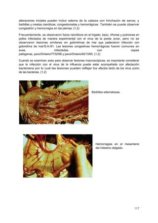 117
alteraciones iniciales pueden incluir edema de la cabeza con hinchazón de senos; y
barbillas y crestas cianóticas, congestionadas y hemorrágicas. También se puede observar
congestión y hemorragia en las piernas. (1,2)
Frecuentemente, se observaron focos necróticos en el hígado, bazo, riñones y pulmones en
pollos infectados de manera experimental con el virus de la peste aviar, pero no se
observaron lesiones similares en golondrinas de mar que padecieron infección con
golondrina de mar/S.A./61. Las lesiones congestivas hemorrágicas fueron comunes en
aves infectadas con cepas
patógenas, pavo/Ontario/7732/66 y pavo/Ontario/6213/65. (1,2)
Cuando se examinan aves para observar lesiones macroscópicas, es importante considerar
que la infección con el virus de la influenza puede estar acompañada con afectación
bacteriana por lo cual las lesiones pueden reflejar los efectos tanto de los virus como
de las bacterias. (1,2)
Barbillas edematosas.
Hemorragias en el mesenterio
del intestino delgado.
 