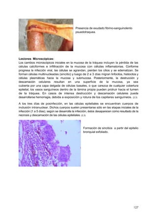 127
Presencia de exudado fibrino-sanguinolento
psuedotraquea.
Lesiones Microscópicas:
Los cambios microscópicos iniciales en la mucosa de la tráquea incluyen la pérdida de las
células calciformes e infiltración de la mucosa con células inflamatorias. Conforme
progresa la infección viral, las células se agrandan, pierden los cilios y se edematizan. Se
forman células multinucleadas (sincitio) y luego de 2 a 3 días migran linfocitos, histiocitos y
células plasmáticas hacia la mucosa y submucosa. Posteriormente, la destrucción y
descamación celulares resultan en una superficie de la mucosa, ya sea
cubierta por una capa delgada de células basales, o que carezca de cualquier cobertura
epitelial, los vasos sanguíneos dentro de la lámina propia pueden protruir hacia el lumen
de la tráquea. En casos de intensa destrucción y descamación celulares puede
desarrollarse hemorragia, debida a exposición y rotura de los capilares sanguíneos. (2,3)
A los tres días de posinfección, en las células epiteliales se encuentran cuerpos de
inclusión intranuclear. Dichos cuerpos suelen presentarse sólo en las etapas iniciales de la
infección (1 a 5 días), según se desarrolla la infección, éstos desaparecen como resultado de la
necrosis y descamación de las células epiteliales. (2,3)
Formación de sincitios a partir del epitelio
bronquial exfoliado.
 