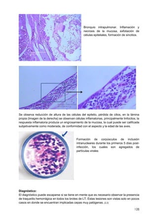 128
Bronquio intrapulmonar. Inflamación y
necrosis de la mucosa, exfoliación de
células epiteliales, formación de sincitios.
Se observa reducción de altura de las células del epitelio, pérdida de cilios, en la lámina
propia (Imagen de la derecha) se observan células inflamatorias, principalmente linfocitos; la
respuesta inflamatoria produce un engrosamiento de la mucosa, la cual puede ser calificada
subjetivamente como moderada, de conformidad con el aspecto y la edad de las aves.
Formación de corpúsculos de inclusión
intranucleares durante los primeros 5 días post-
infección, los cuales son agregados de
partículas virales
Diagnóstico:
El diagnóstico puede escaparse si se tiene en mente que es necesario observar la presencia
de traqueítis hemorrágica en todos los brotes de LT. Estas lesiones son vistas solo en pocos
casos en donde se encuentran implicadas cepas muy patógenas. (2,3)
 