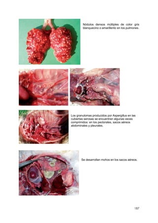 187
Nódulos densos múltiples de color gris
blanquecino o amarillento en los pulmones.
Los granulomas producidos por Aspergillus en las
cubiertas serosas se encuentran algunas veces
comprimidos: en los pectorales, sacos aéreos
abdominales y pleurales.
Se desarrollan mohos en los sacos aéreos.
 