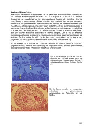188
Lesiones Microscópicas:
El examen de los tejidos pulmonares de los pavipollos no mostró alguna diferencia en
las lesiones histopatológicas causadas por A. fumigatus o A. flavus. Las lesiones
tempranas se caracterizaron por acumulaciones focales de linfocitos, algunos
macrófagos y unas cuantas células gigantes. Más adelante, las lesiones estuvieron
constituidas por granulomas con una zona central de necrosis con heterófilos rodeados por
macrófagos, células gigantes, linfocitos y algún tejido fibroso. Ocho semanas después de la
exposición, los pavipollos sobrevivientes tenían lesiones granulomatosas constituidas
por un Centro necrótico rodeado por células gigantes y una capa gruesa de tejido fibroso
con unos cuantos heterófilos distribuidos de manera irregular. Con el use de tinciones
especiales para hongos, se observaron microorganismos dentro de las zonas necróticas de las
lesiones. En los cortes de tejido de los bronquios, bronquiolos y sacos aéreos bien
oxigenados, los microorganismos se encontraron espurulando asexualmente.(2)
En las lesiones de la tráquea, las oclusiones consistían en miselios micóticos y exudado
piogranulomatoso, mientras en la pared traqueal subyacente resultó evidente que la mucosa
se encontraba necrótica e infiltrada con macrófagos y fibroplasia.(2)
En la aspergillosis aguda se pueden
observar esporas del hongo entre las
masas inflamatorias necróticas (flecha a)
así como el crecimiento de hifas (flecha
b).
En la forma nodular se encuentran
estructuras granulomatosas
características de Aspergillus en los
tejidos.
 