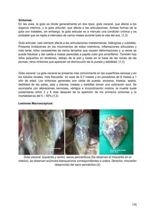 198
Síntomas:
En las aves, la gota se divide generalmente en dos tipos, gota visceral, que afecta a los
órganos internos, y la gota articular, que afecta a las articulaciones. Ambas formas de la
gota son tratables, sin embargo, la gota articular es a menudo una condición crónica y es
probable que se repita a intervalos de varios meses durante toda la vida del ave. (1,3)
Gota articular: casi siempre afecta a las articulaciones metatarsianas, falángicas y cubitales.
Presenta limitaciones en los movimientos de estos miembros, inflamaciones articulares y
más tarde, tofos consistentes de varios tamaños que causan deformaciones y, a veces se
puede fistulizar y dar salida a masas parecidas a papilla color gris amarillento. También hay
tofos pequeños en tendones, debajo de la piel y hasta en la base de las raíces de las
plumas, otros síntomas que aparecen es disminución de la puesta y debilidad. (1,3)
Gota visceral: La gota visceral se presenta más comúnmente en las superficies serosas y en
los túbulos renales. más frecuente en aves de 5-7 meses y en ponedoras de 8 meses a 1
año de edad. Los síntomas generales son caída de puesta, anorexia, tristeza, apatía,
debilidad de las patas, alas y diarrea, crestas y barbillas toman una coloración azul. Se
acompaña con alteraciones nerviosas, vértigos e incoordinación motora, la muerte suele
presentarse entre 3 y 6 días después de la aparición de los primeros síntomas y la
mortalidad es del 5 – 50%.(1,3)
Lesiones Macroscópicas:
Gota visceral. Izquierda y centro: sacos pericárdicos (Se observan el miocardio en el
interior), se observan acúmulos blanquecinos correspondientes a uratos. Derecha: miocardio
desprovisto del saco pericárdico (2)
 