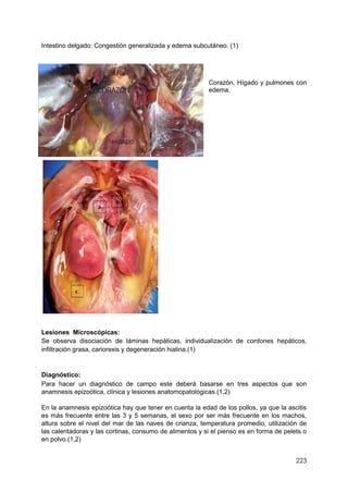 223
Intestino delgado: Congestión generalizada y edema subcutáneo. (1)
Corazón, Hígado y pulmones con
edema.
Lesiones Microscópicas:
Se observa disociación de láminas hepàticas, individualización de cordones hepáticos,
infiltración grasa, cariorexis y degeneración hialina.(1)
Diagnóstico:
Para hacer un diagnóstico de campo este deberá basarse en tres aspectos que son
anamnesis epizoótica, clínica y lesiones anatomopatológicas.(1,2)
En la anamnesis epizoótica hay que tener en cuenta la edad de los pollos, ya que la ascitis
es más frecuente entre las 3 y 5 semanas, el sexo por ser más frecuente en los machos,
altura sobre el nivel del mar de las naves de crianza, temperatura promedio, utilización de
las calentadoras y las cortinas, consumo de alimentos y si el pienso es en forma de pelets o
en polvo.(1,2)
 