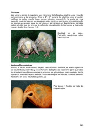 245
Síntomas:
Los primeros signos de raquitismo son: incremento de la fosfatasa alcalina sérica y retardo
del crecimiento y del emplume. Entre la 2º y 3º semana de edad los pollos presentan
debilidad de patas, marcha torpe, plumas erizadas, postraciónón, la apatía es muy
evidente y cuando las aves son asustadas, estas corren un trecho corto e inmediatamente
se postran apoyándose sobre los corvejones y permanecen así durante largos períodos
debido al dolor que les provoca la deficiente mineralización de los huesos y finalmente
mueren al cabo de un tiempo. (1,3)
Debilidad en las patas,
Postración apoyándose sobre
los corvejones.
Lesiones Macroscópicas:
Aunado al retraso en el aumento de peso y el crecimiento deficiente, se aprecia hipertrofia
de las glándulas paratiroides y ensanchamiento de la placa de crecimiento por lo que todas
las articulaciones están aumentadas de volumen, las articulaciones costo-condrales dan la
apariencia de rosario, el pico, las uñas y los huesos largos son flexibles y blandos pudiendo
fracturarse sin causa traumática aparente.(2)
Pico blando y flexible por falta de
mineralización.
 