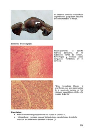 254
Se observan cambios necrobióticos
degenerativos que pueden afectar la
musculatura lisa de la molleja.
Lesiones Microscópicas:
Histológicamente, se detecta
necrosis colicuativa, en la
substancia blanca del cerebro,
hemorragias y múltiples vasos
sanguíneos trombóticos en el
cerebelo.
Fibras musculares blancas o
amarillentas, que son responsables
de la apariencia estriada de los
músculos esqueléticos debido a la
necrosis de Zenker
Diagnóstico:
 Análisis del alimento para determinar los niveles de vitamina E.
 Histopatología y necropsia observando las lesiones características de distrofia
muscular, encefalomalasia y diátesis exudativa. (3)
 