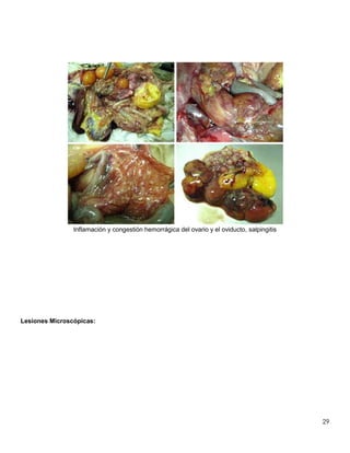 29
Inflamación y congestión hemorrágica del ovario y el oviducto, salpingitis
Lesiones Microscópicas:
 