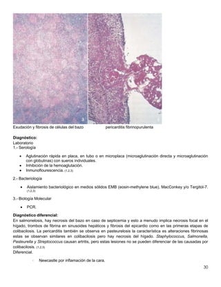 30
Exudación y fibrosis de células del bazo pericarditis fibrinopurulenta
Diagnóstico:
Laboratorio
1.- Serología
 Aglutinación rápida en placa, en tubo o en microplaca (microaglutinación directa y microaglutinación
con globulinas) con sueros individuales.
 Inhibición de la hemoaglutación.
 Inmunoflourescencia. (1,2,3)
2.- Bacteriología
 Aislamiento bacteriológico en medios sólidos EMB (eosin-methylene blue), MacConkey y/o Tergitol-7.
(1,2,3)
3.- Biología Molecular
 PCR.
Diagnóstico diferencial:
En salmonelosis, hay necrosis del bazo en caso de septicemia y esto a menudo implica necrosis focal en el
hígado, trombos de fibrina en sinusoides hepáticos y fibrosis del epicardio como en las primeras etapas de
colibacilosis. La pericarditis también se observa en pasteurelosis la característica es alteraciones fibrinosas
estas se observan similares en colibacilosis pero hay necrosis del hígado. Staphylococcus, Salmonella,
Pasteurella y Streptococcus causan artritis, pero estas lesiones no se pueden diferenciar de las causadas por
colibacilosis. (1,2,3)
Diferencial.
· Newcastle por inflamación de la cara.
 