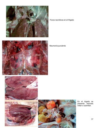 37
Focos necróticos en el Hígado
Neumonía purulenta
En el hígado se
presenta necrosis
miliar o submiliar.
 