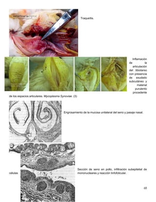 68
Traqueítis.
Inflamación
de la
articulación
del tibiotarso
con presencia
de exudado
subcutáneo y
material
purulento
procedente
de los espacios articulares. Mycoplasma Synoviae. (3)
Engrosamiento de la mucosa unilateral del seno y pasaje nasal.
Sección de seno en pollo, infiltración subepitelial de
células mononucleares y reacción linfofolicular.
 